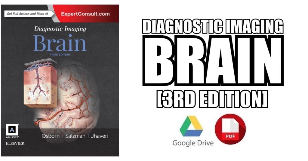 Diagnostic Imaging Brain 3rd Edition PDF Free Download [Direct Link]