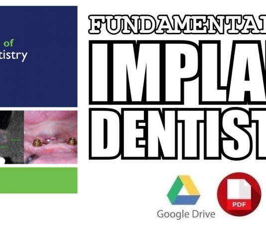 Fundamentals of Implant Dentistry 1st Edition PDF