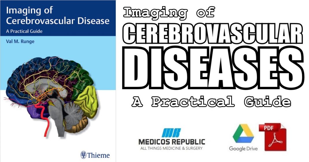 imaging-of-cerebrovascular-disease-a-practical-guide-pdf-free-download