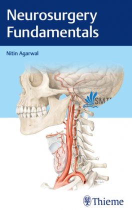 Neurosurgery Fundamentals PDF Free Download [Direct Link]