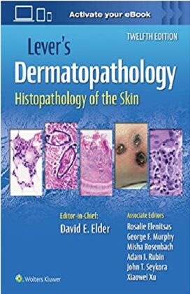 Lever's Dermatopathology: Histopathology Of The Skin PDF Free Download