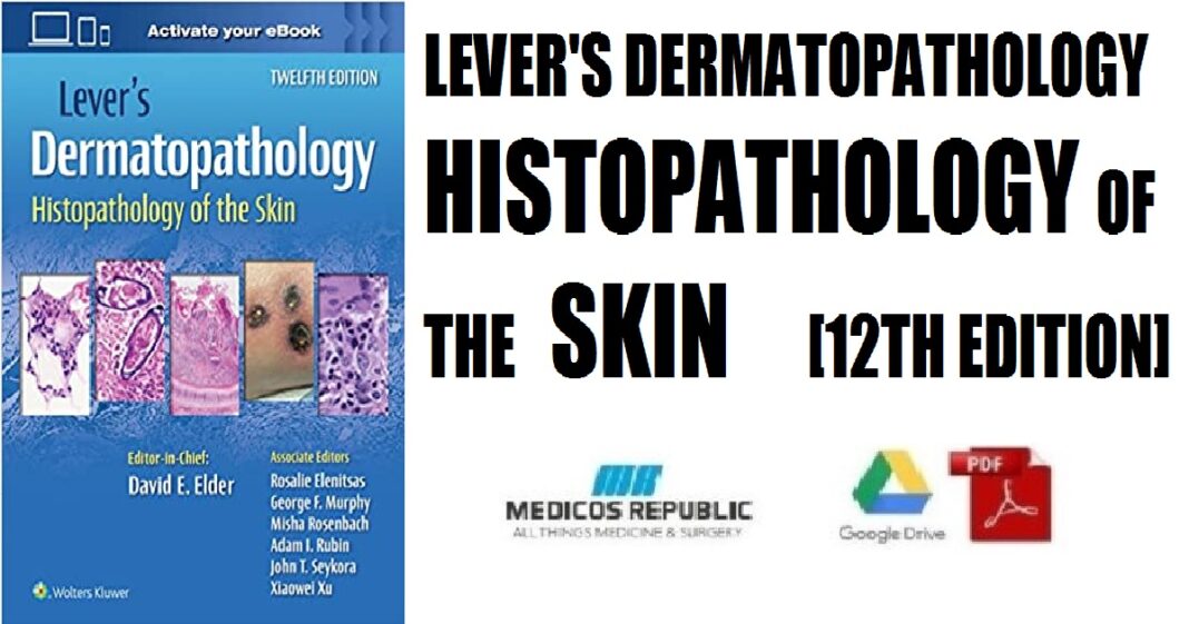 Lever's Dermatopathology: Histopathology Of The Skin PDF Free Download