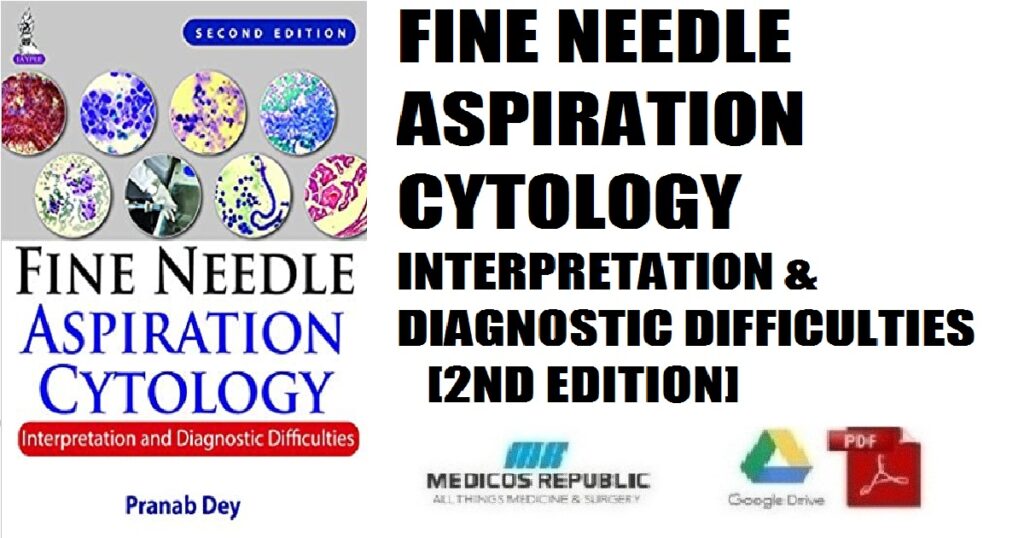 Fine Needle Aspiration Cytology PDF Free Download [Direct Link]