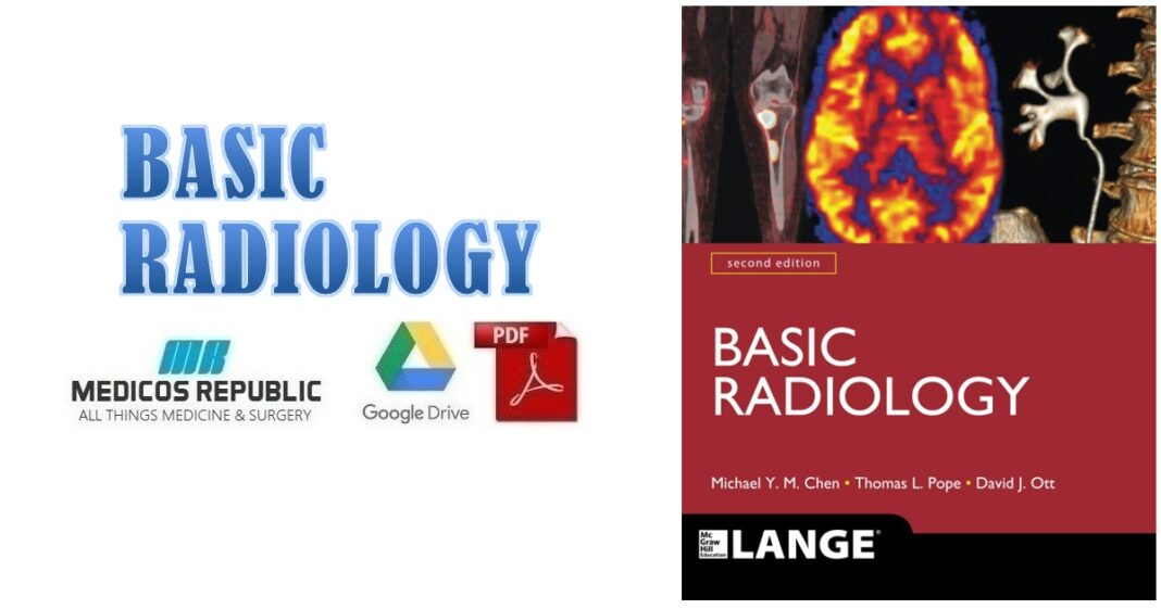 Basic Radiology 2nd Edition PDF Free Download [Direct Link]