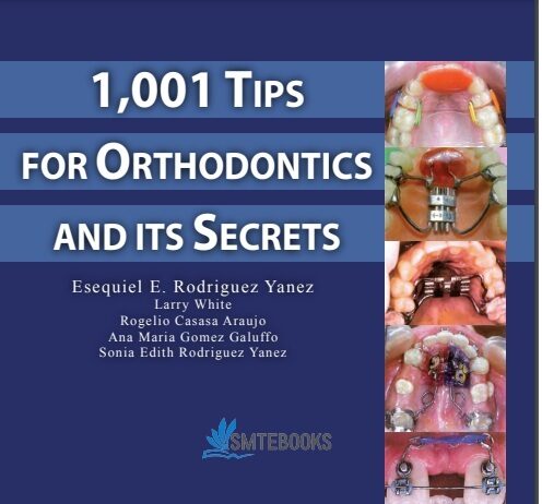 1001 Tips For Orthodontics And Its Secrets PDF