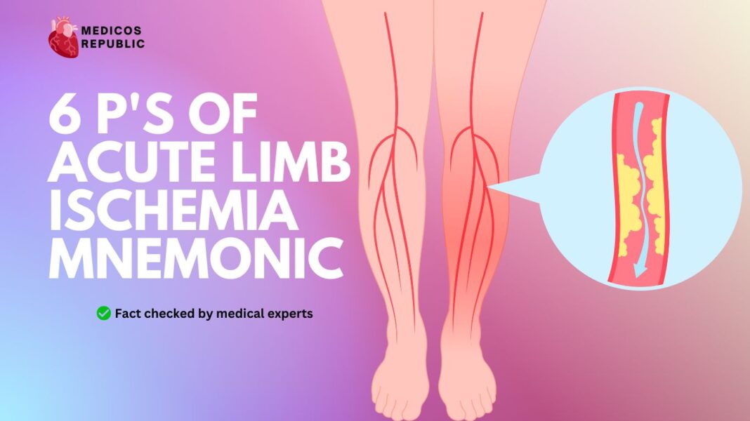 6-p-s-of-acute-limb-ischemia-mnemonic-signs-of-arterial-occlusion