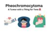 Pheochromocytoma