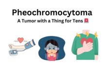 Pheochromocytoma