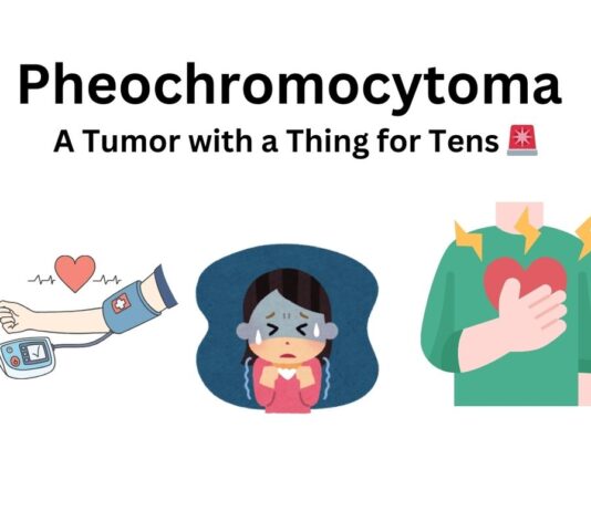 Pheochromocytoma